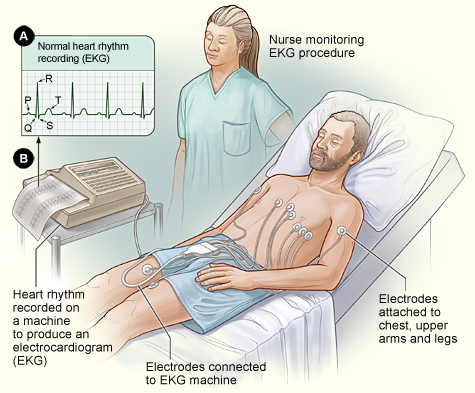 Electrocardiogram Image